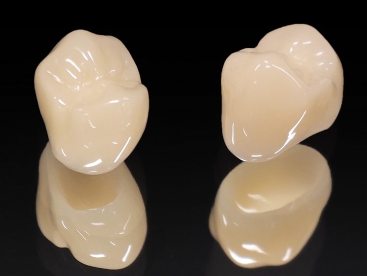 プラスチックの詰め物・被せ物