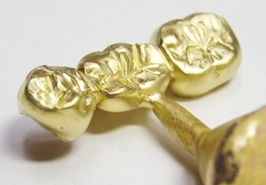 金歯