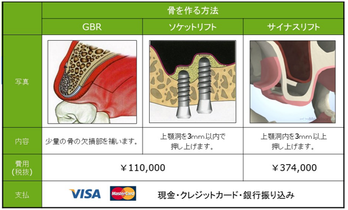 インプラント治療費のご案内