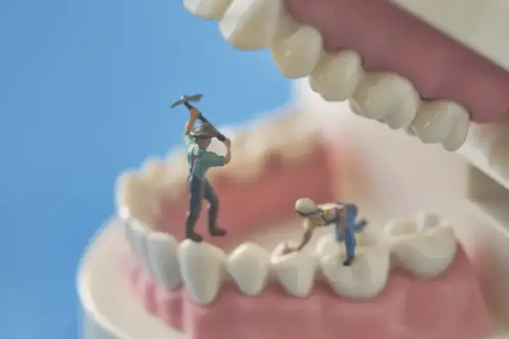健全歯へのダメージが大きい