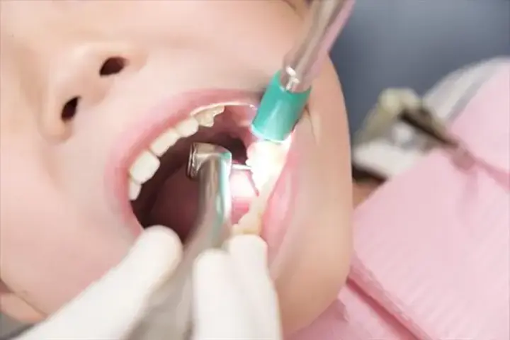 治療主体でない、予防歯科を軸とした治療