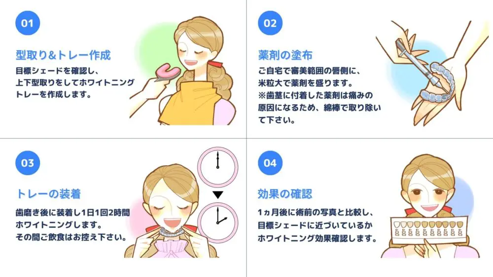 ホームホワイトニングのやり方】自由な時間で白さを手に入れる | 墨田