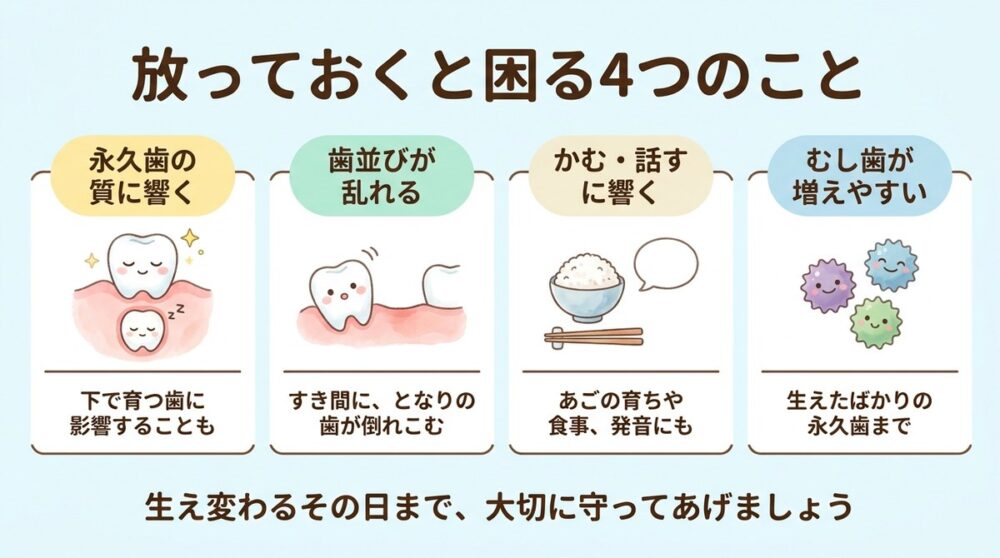 乳歯のむし歯を放っておくと困る4つのこと。永久歯の質に響く、歯並びが乱れる、かむ・話すに響く、むし歯が増えやすい