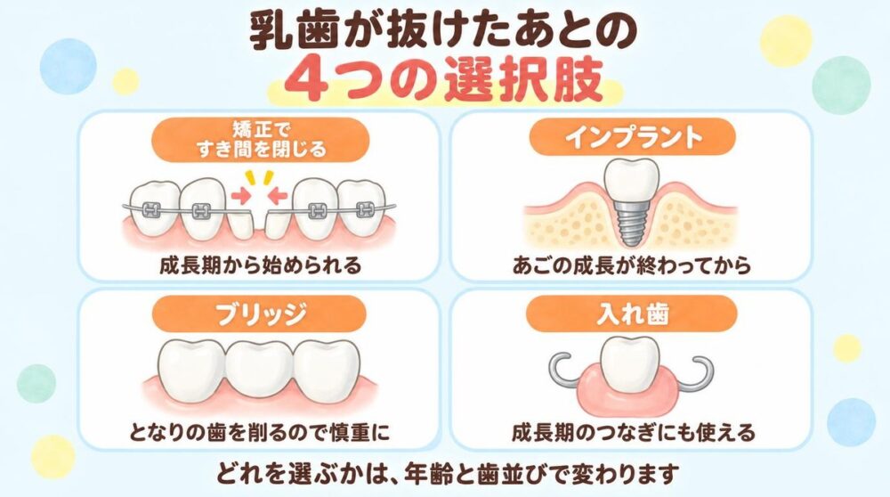 乳歯が抜けたあとの4つの選択肢。矯正ですき間を閉じる、インプラント、ブリッジ、入れ歯