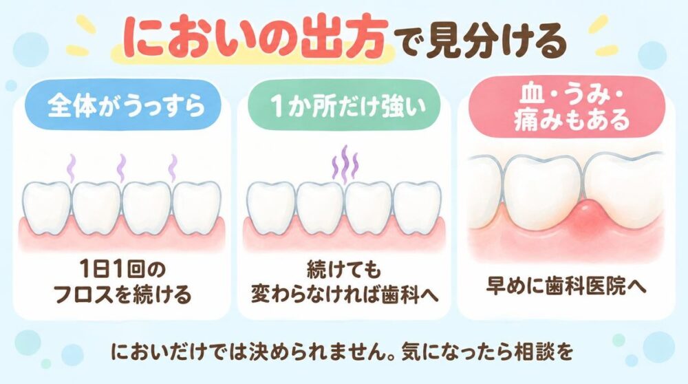フロスのにおいの出方で見分ける図：全体がうっすらなら1日1回のフロスを続ける、1か所だけ強いなら続けても変わらなければ歯科へ、血・うみ・痛みもあるなら早めに歯科医院へ