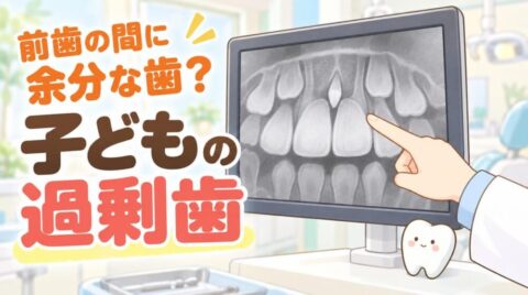 子どもの歯のレントゲン写真で、上の前歯の間にある小さな過剰歯を歯科医師が指さしているイラスト