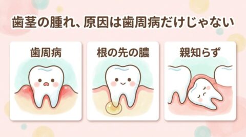 歯茎の腫れの3つの原因、歯周病・根の先の膿・親知らずのイラスト