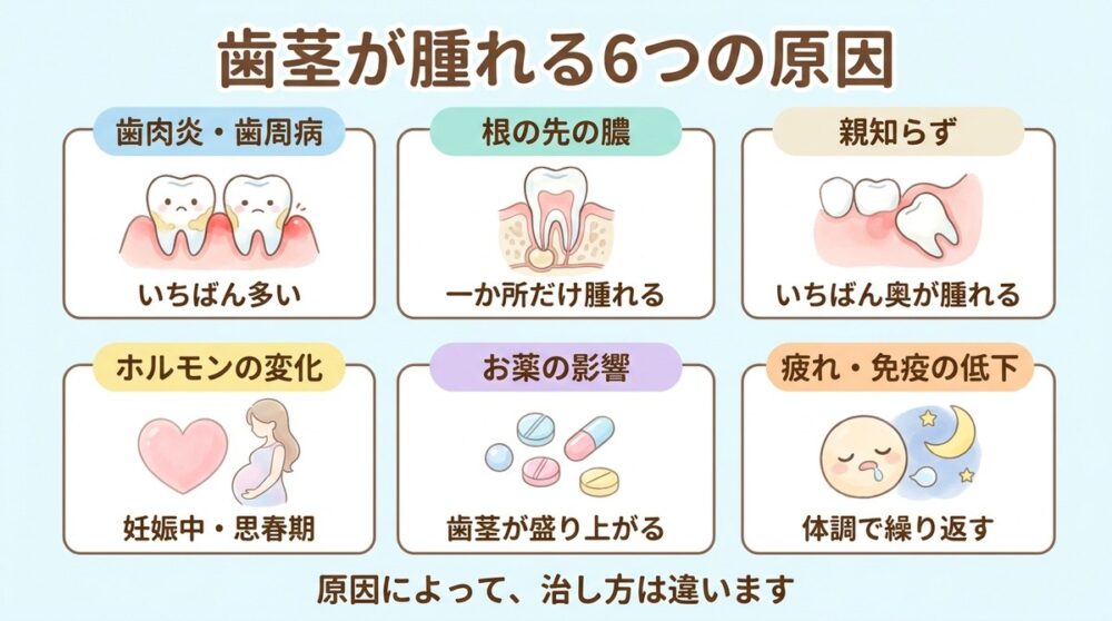 歯茎が腫れる6つの原因。歯肉炎・歯周病、根の先の膿、親知らず、ホルモンの変化、お薬の影響、疲れ・免疫の低下