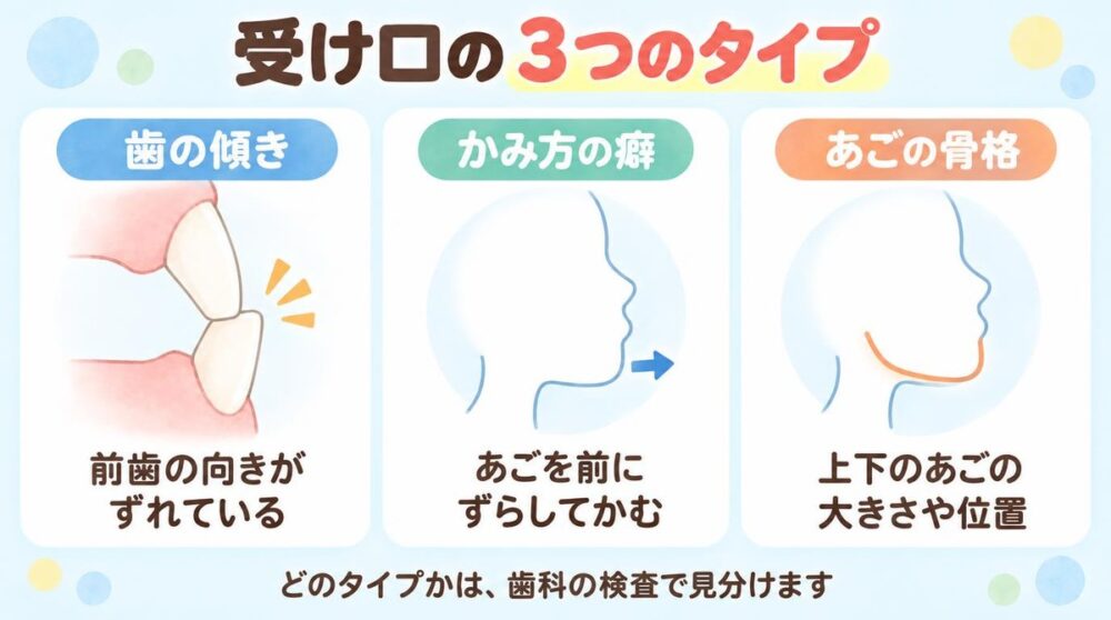 受け口の3つのタイプ。歯の傾き、かみ方の癖、あごの骨格