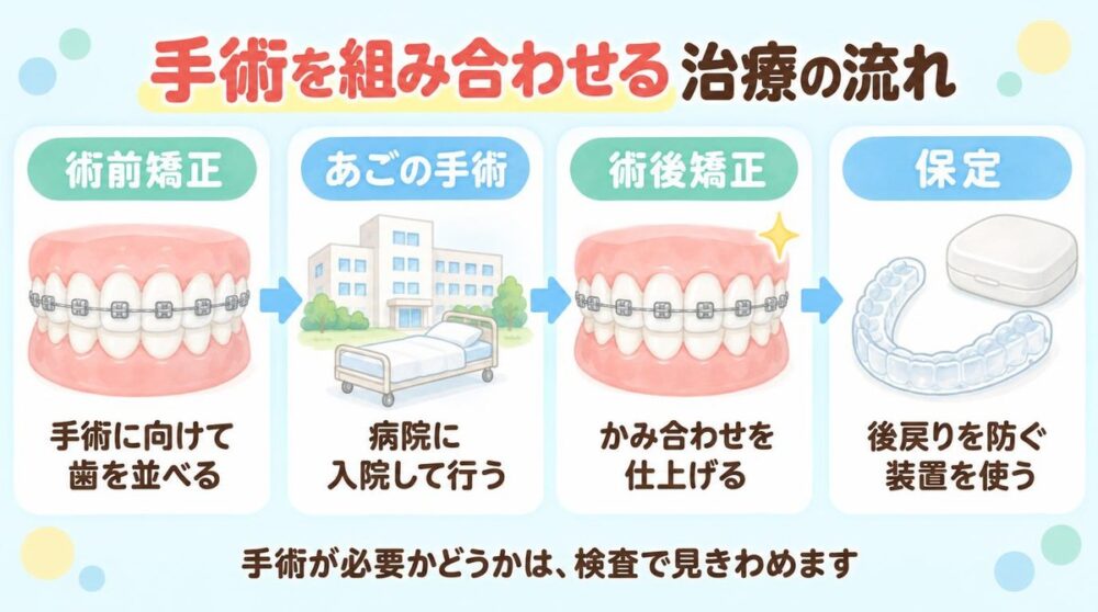 手術を組み合わせる治療の流れ。術前矯正、あごの手術、術後矯正、保定